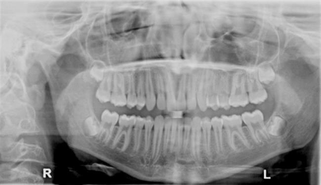 dental-x-ray-1